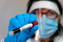 لم يتم تسجيل أي حالات إصابة جديدة بفيروس كورونا​ المستجد في طاجيكستان خلال اليوم الماضى