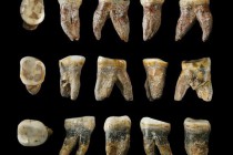 Археологи нашли древние человеческие зубы с пломбами