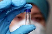 Экспериментальная вакцина против ВИЧ сработала и защитила приматов