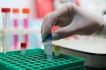 Российские ученые создали высокоточный тест для диагностики коронавируса