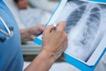 За сутки в Казахстане зафиксированы 828 случаев пневмонии с признаками КВИ и 13 летальных исходов
