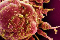 Коронавирус: ученые выявили гены, от которых зависит тяжесть болезни