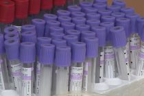 В мире за сутки выявлено более 400 тыс. случаев заражения коронавирусом