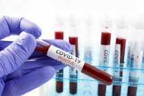 COVID-19. В Таджикистане зарегистрировано 84 новых случая заражения коронавирусом