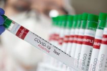 COVID-19. В Таджикистане зарегистрировано 78 новых случаев инфицирования коронавирусом