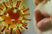 Что такое герпес и как избежать заражения им?