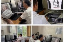 Дар марказҳои саратоншиносии Тоҷикистон низоми муосири бойгонӣ ва интиқоли аксҳои рентгенӣ татбиқ гардид